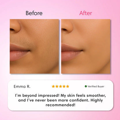 Hair Removal Trilogy Kit